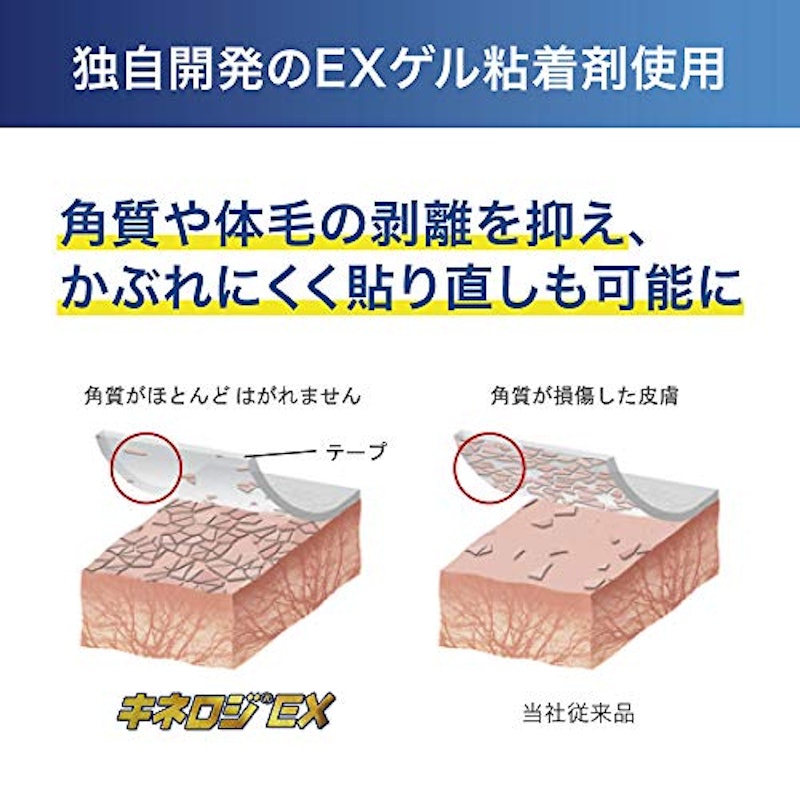 ニトリート キネロジEX 4