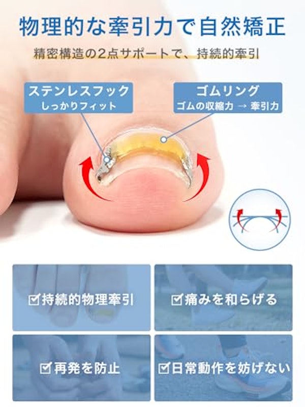 巻き爪矯正器具 4