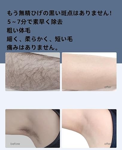  メンズ 除毛クリーム 4