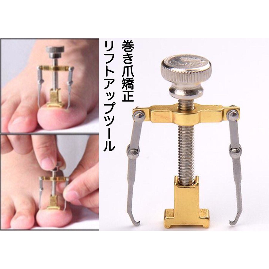 21年 巻き爪グッズのおすすめ人気ランキング10選 Mybest