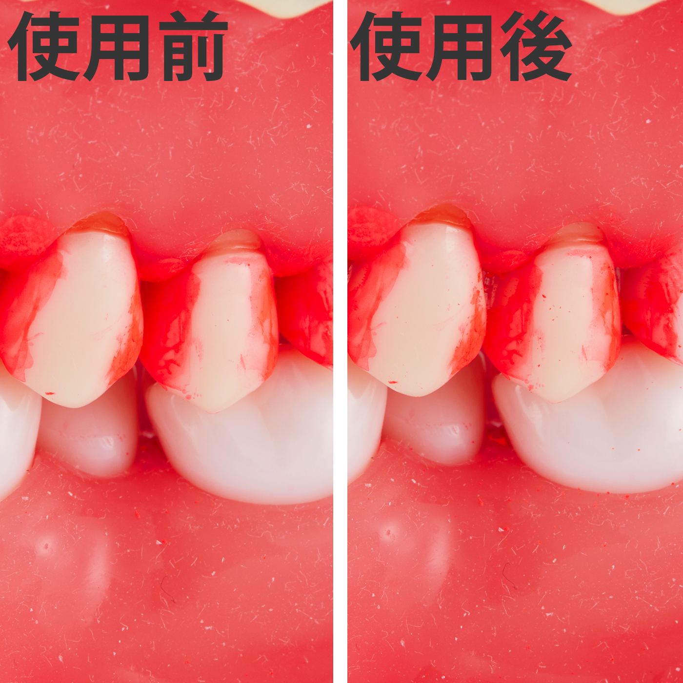 徹底比較 歯間ブラシのおすすめ人気ランキング42選 21年最新版 Mybest