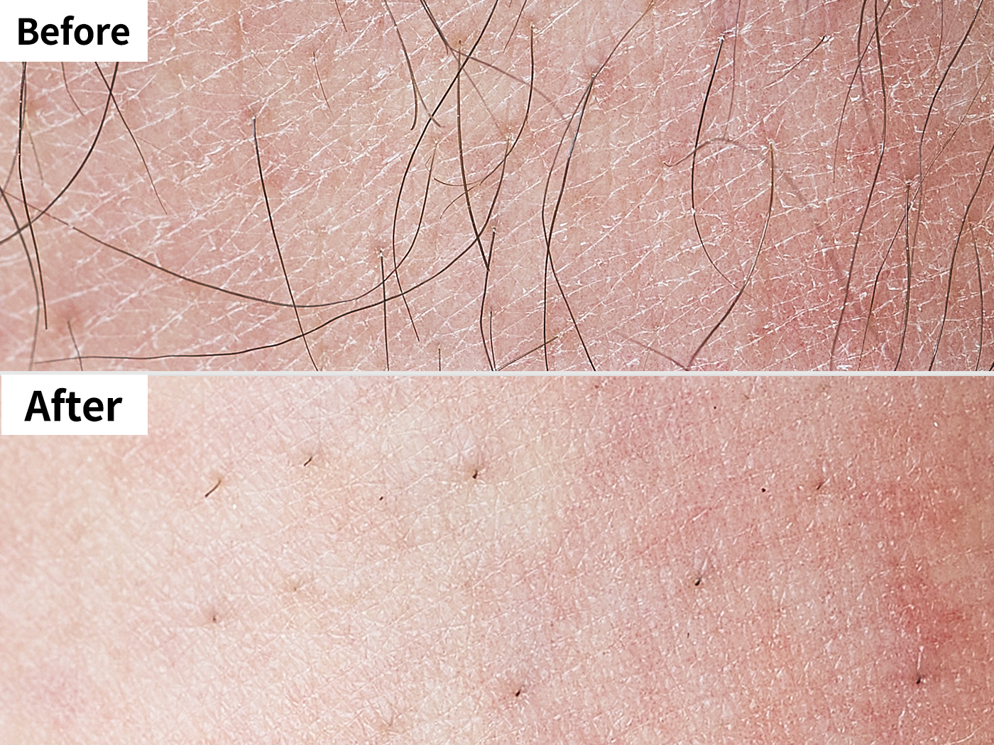 Neoskin 除毛クリームを他商品と比較 口コミや評判を実際に使ってレビューしました Mybest