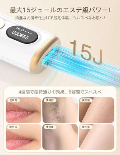 脱毛器 4