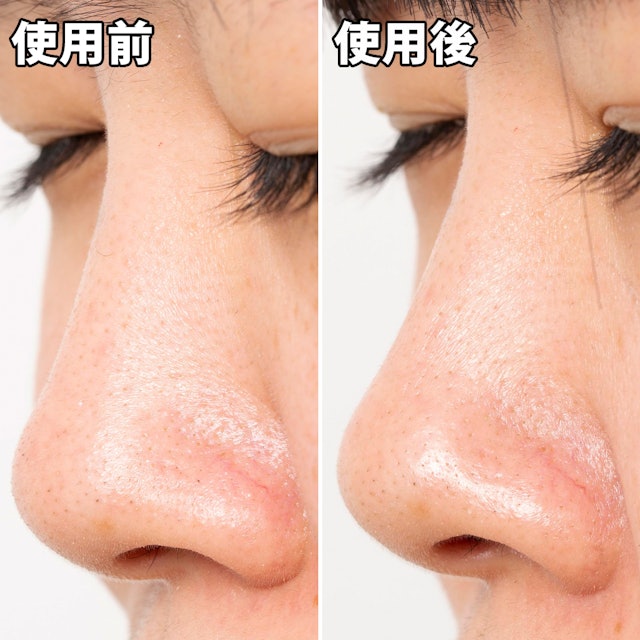ツルリ ねっちり密着 スッキリはがすパックを他商品と比較 口コミや評判を実際に使ってレビューしました Mybest