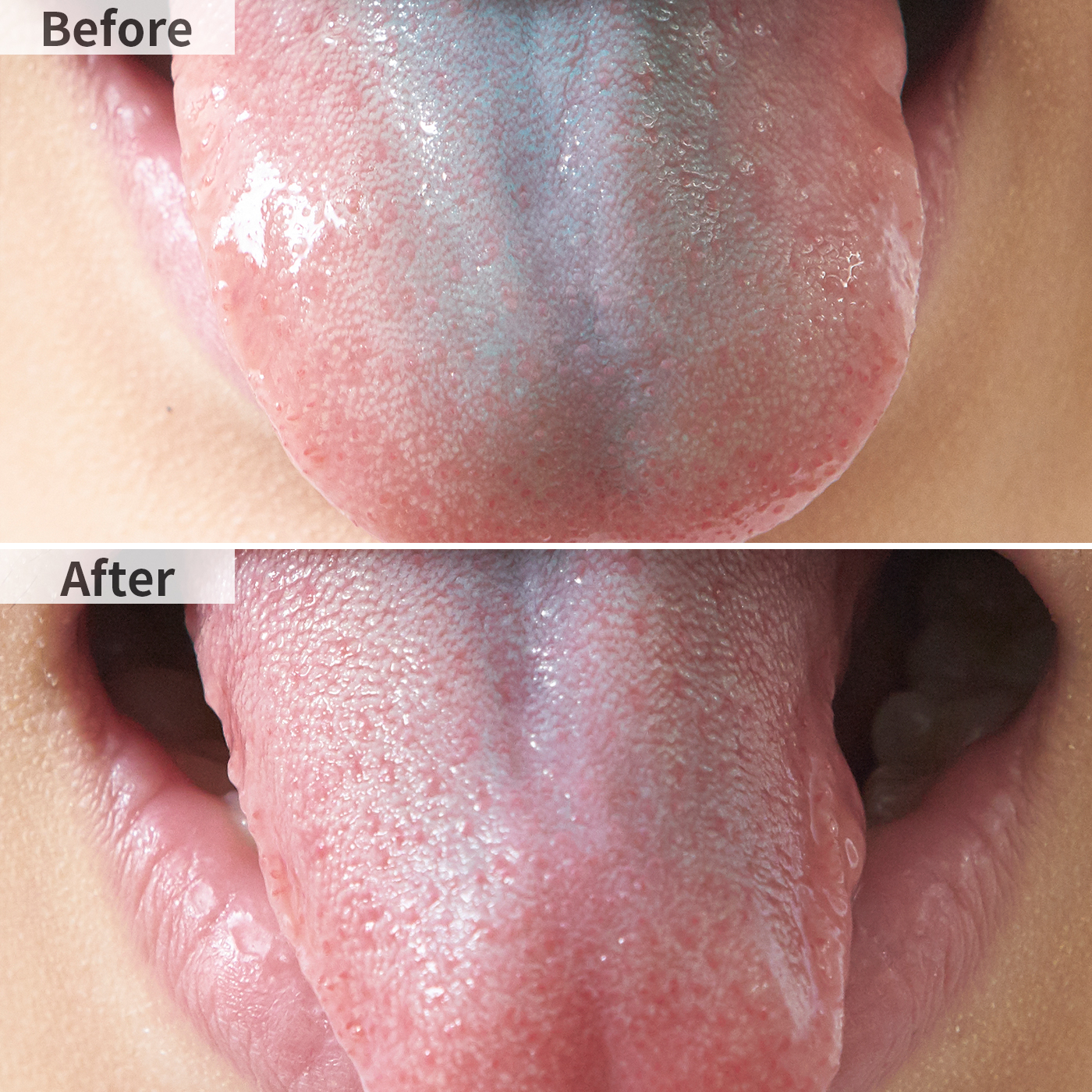 21年 舌ジェルのおすすめ人気ランキング18選 徹底比較 Mybest