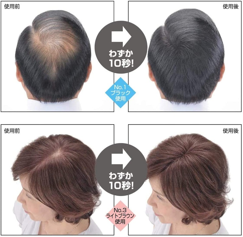 スーパーミリオンヘアーEX 2