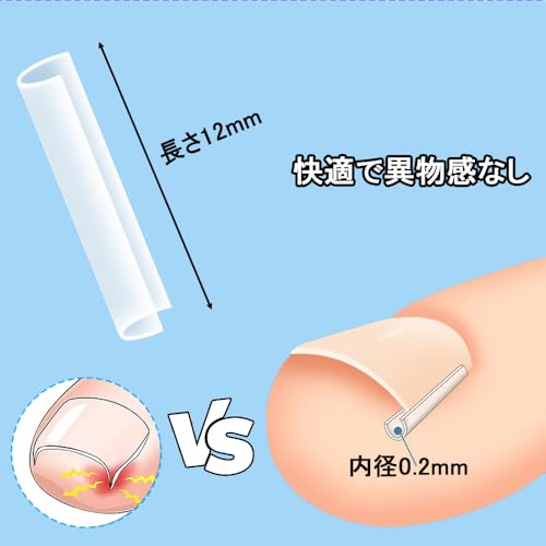 巻き爪クリップ 2