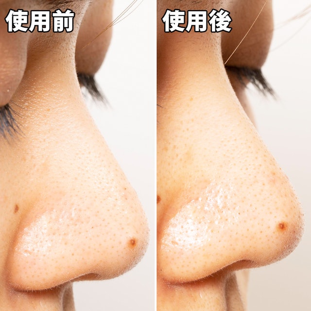 Matsukiyo 毛穴パック炭を他商品と比較 口コミや評判を実際に使ってレビューしました Mybest Matsukiyo 毛穴パック炭を他商品と比較 口コミや評判を実際に使ってレビューしました Mybest
