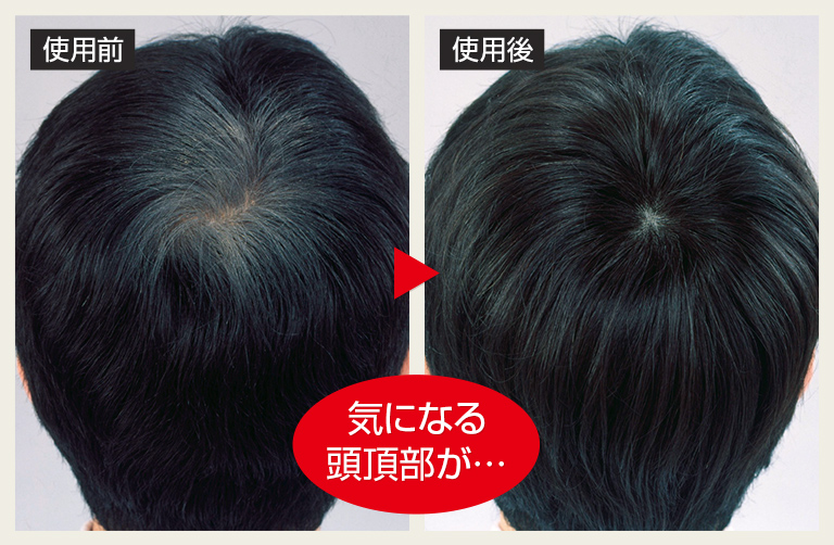 男性用人毛100%つむじピース 2