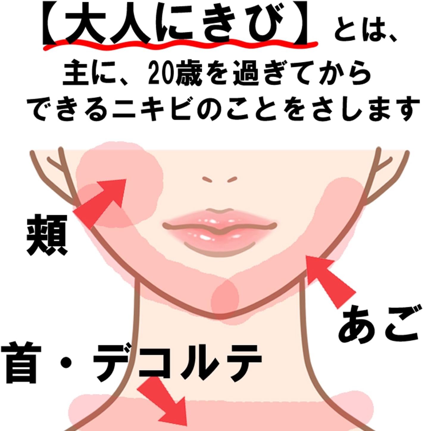 ラウマーアクネクリーム 2