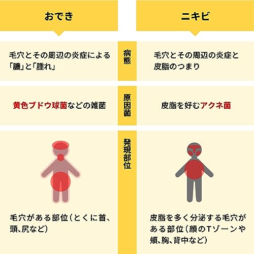 オデキュアEX　 4