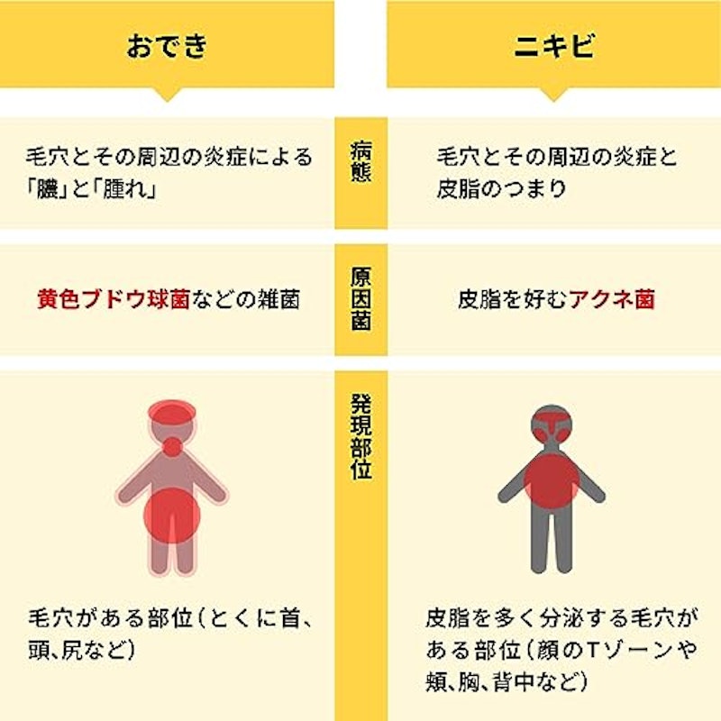 オデキュアEX 4