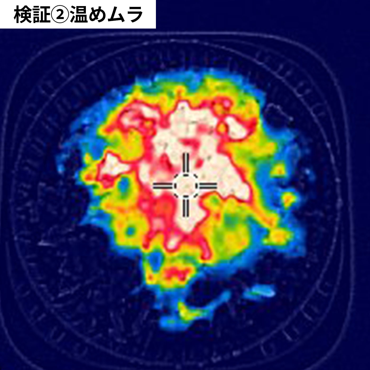 蒸気であたためる冷凍ごはん容器 7