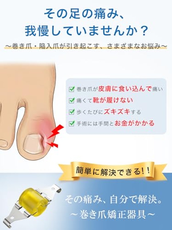 巻き爪矯正器具 3