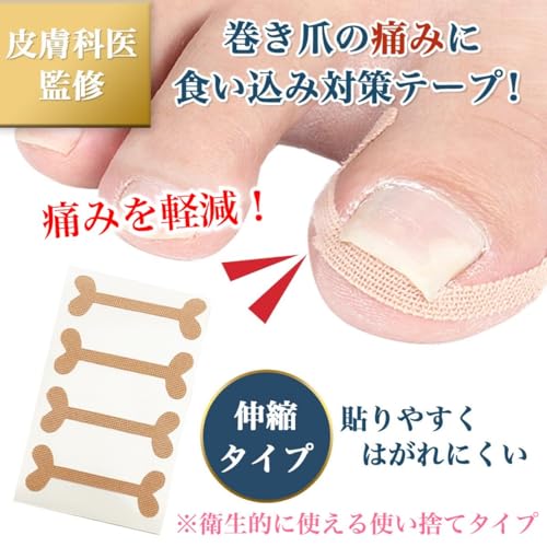 巻き爪テープ 2