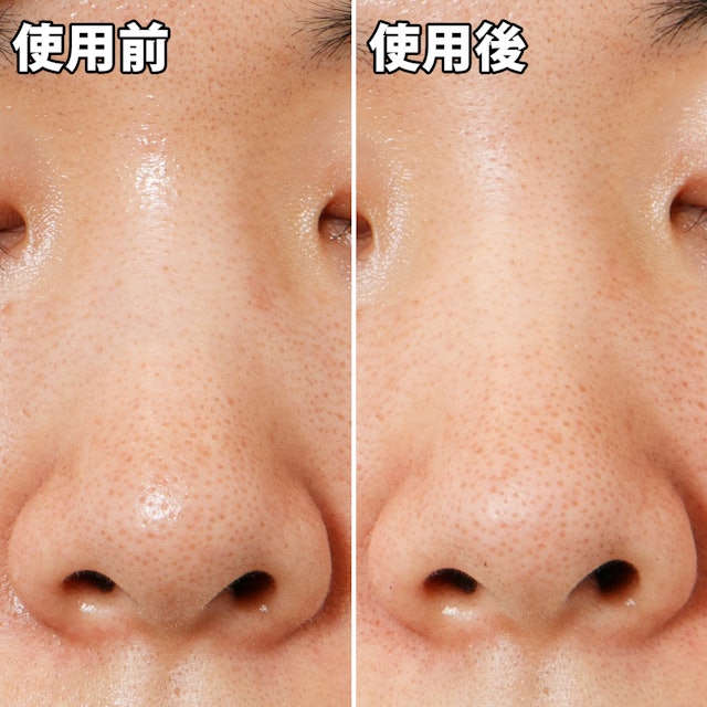 ナリスアップ 毛穴すっきりパックを他商品と比較 口コミや評判を実際に使ってレビューしました Mybest ナリスアップ 毛穴すっきりパックを他商品と比較 口コミや評判を実際に使ってレビューしました Mybest