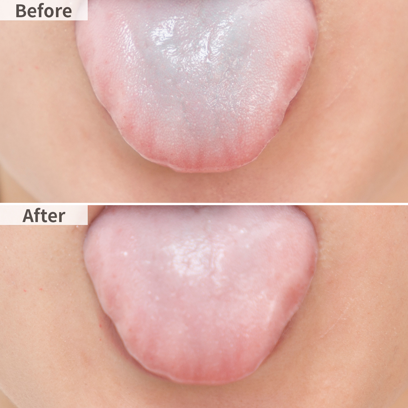 サンスター ガム歯周プロケア 舌ブラシを他商品と比較 口コミや評判を実際に使ってレビューしました Mybest