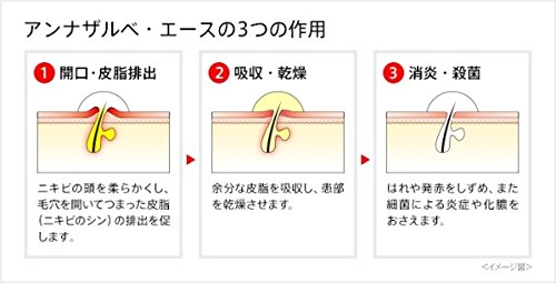 アンナザルベ・エース 6