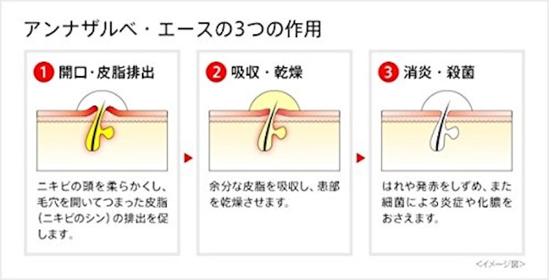 アンナザルベ・エース 6