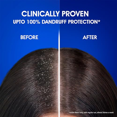 ANTI-DANDRUFF SHAMPOO COOL MENTHOL 7
