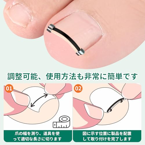 巻き爪クリップ 4