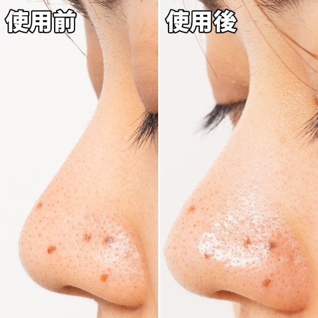 Matsukiyo 毛穴パック炭を他商品と比較 口コミや評判を実際に使ってレビューしました Mybest Matsukiyo 毛穴パック炭を他商品と比較 口コミや評判を実際に使ってレビューしました Mybest