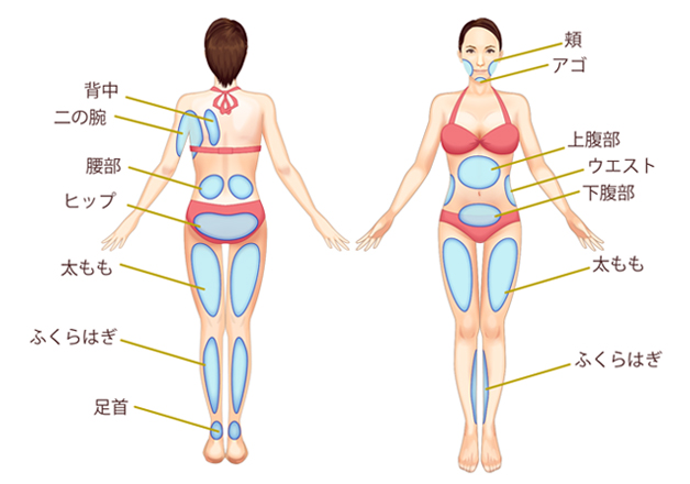 東京美容外科 脂肪吸引 3
