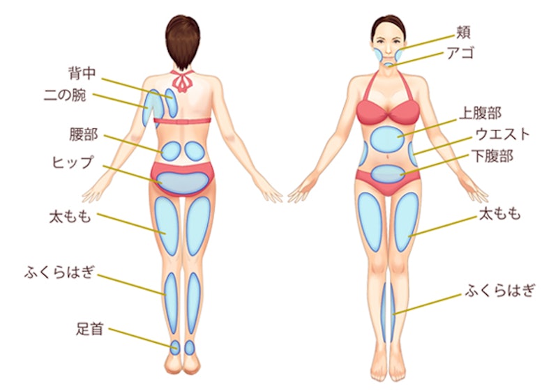 東京美容外科 脂肪吸引 3