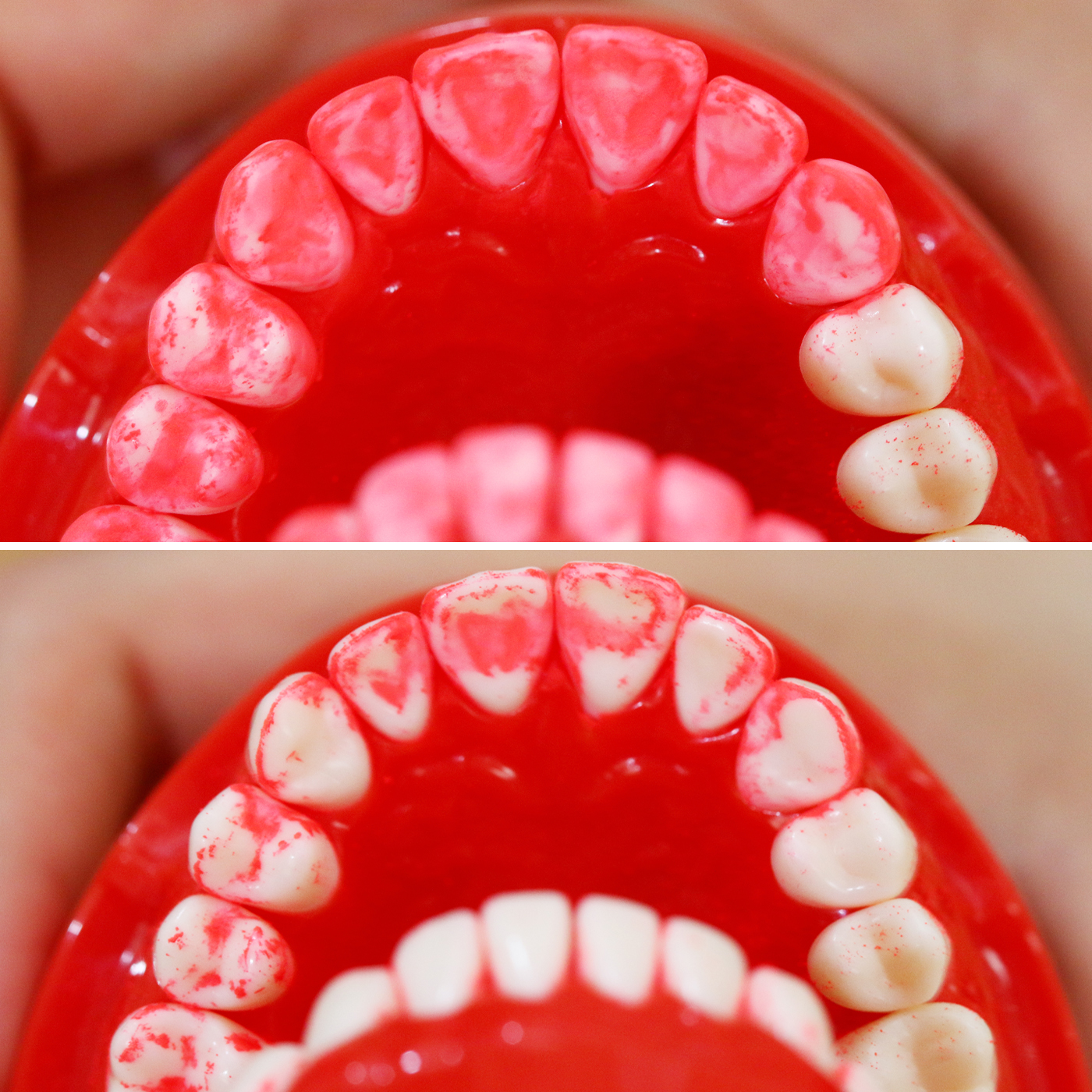 ソニッケアー イージークリーンを全44商品と比較 口コミや評判を実際に使ってレビューしました Mybest