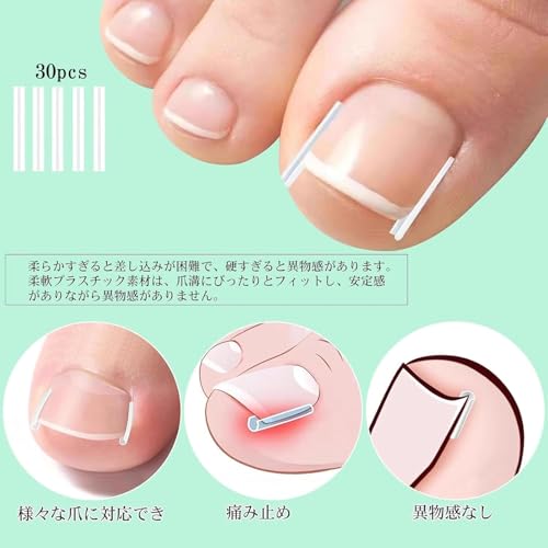 巻き爪クリップ 3
