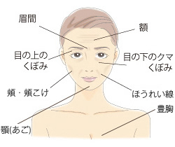 美容皮膚科タカミクリニック ヒアルロン酸注射 2