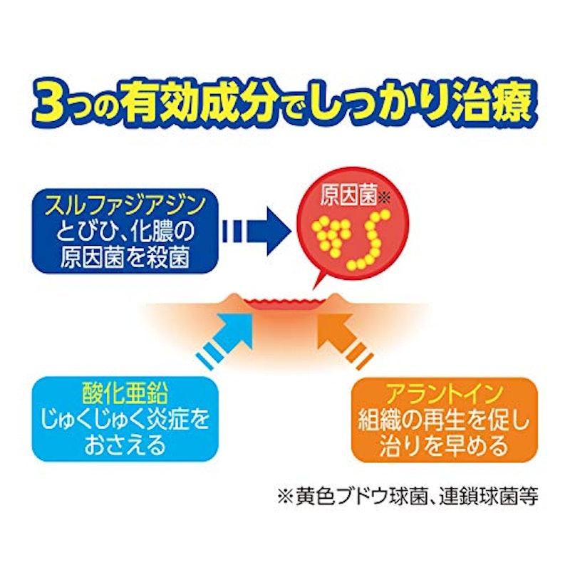 オノフェF 4