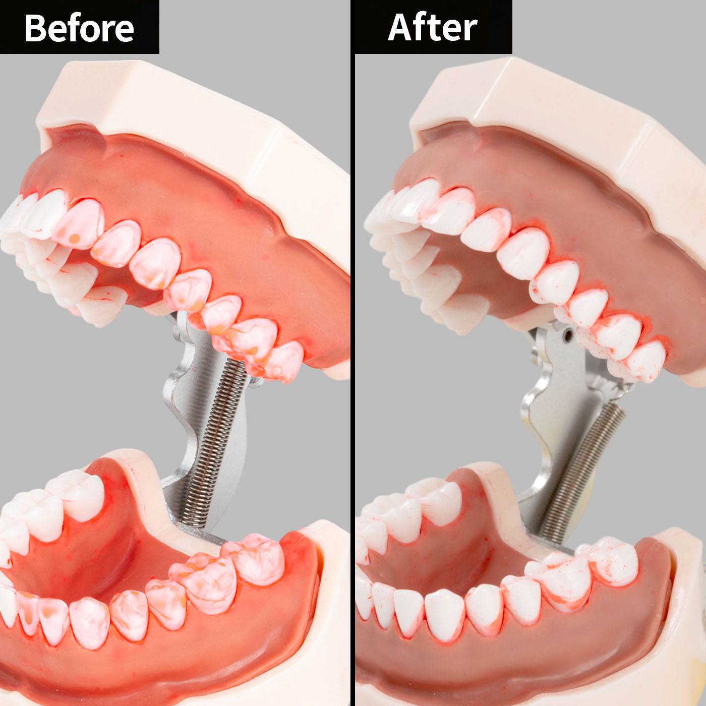 Philips Sonicare 9900 プレステージ HX9992/21を検証レビュー！電動