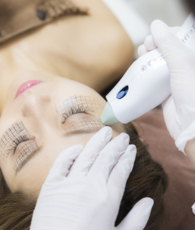 KM新宿クリニック サーマクール 2