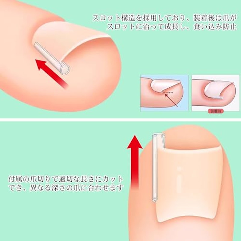 巻き爪クリップ 4