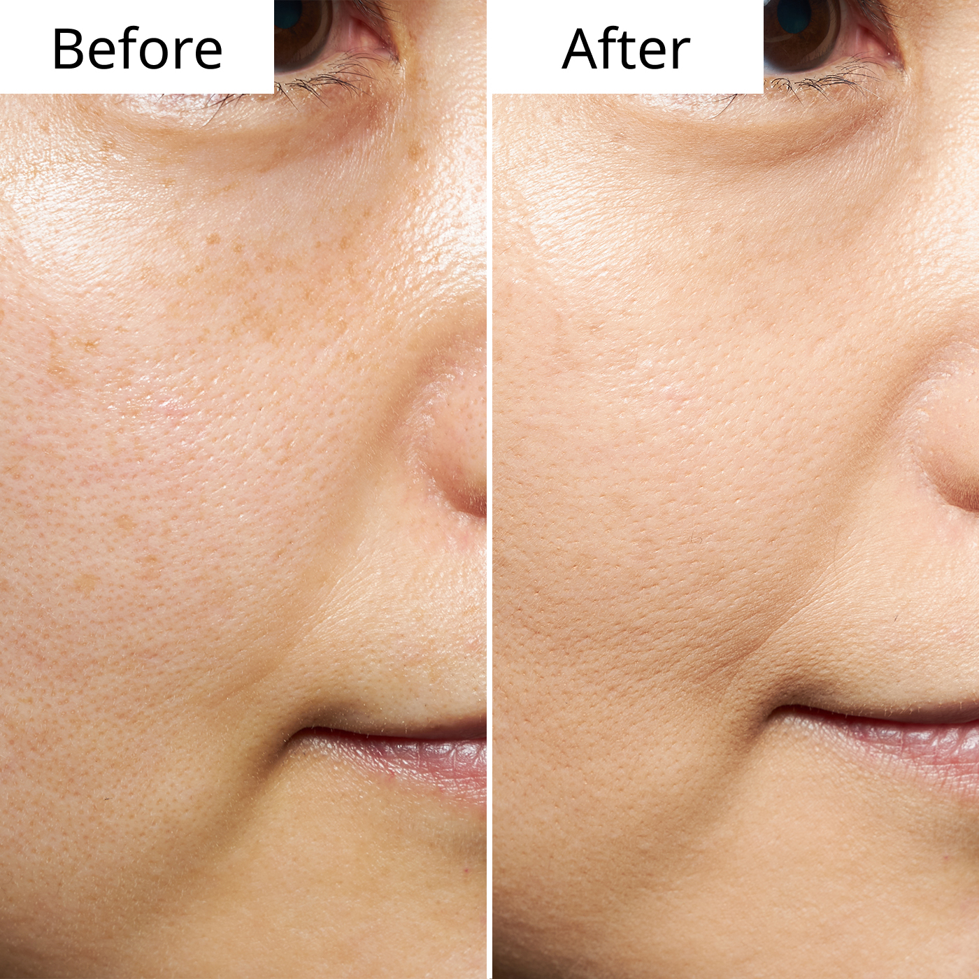 シャネル ウルトラ ル テイント ウルトラウェア オール デイ コンフォート フローレス フィニッシュ ファンデーション - # B20 (Beige) 30ml