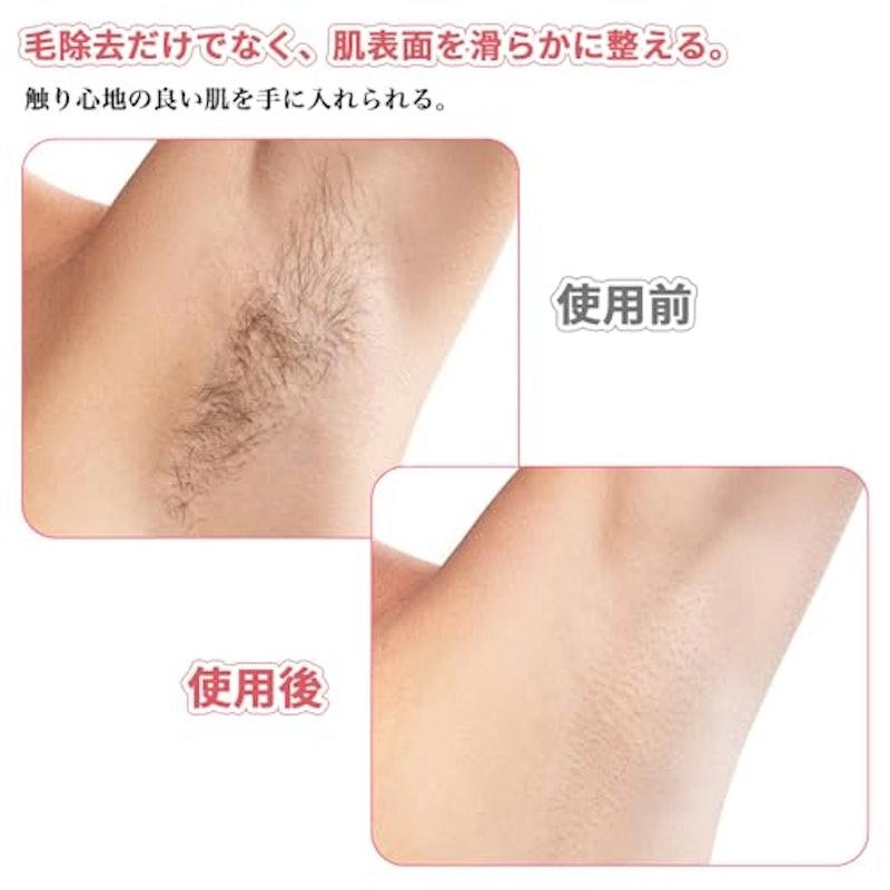 除毛パッド 5