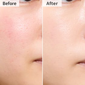 日本ロレアル VALENTINO BEAUTY GO クッション グロウを検証レビュー!40代向けファンデーションの選び方も紹介 4