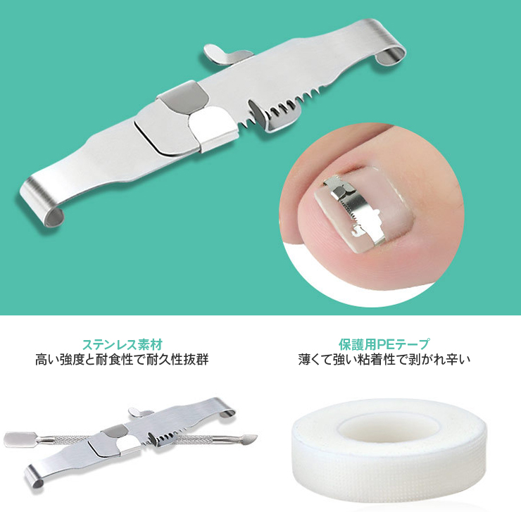 巻き爪ケアクリップ  3