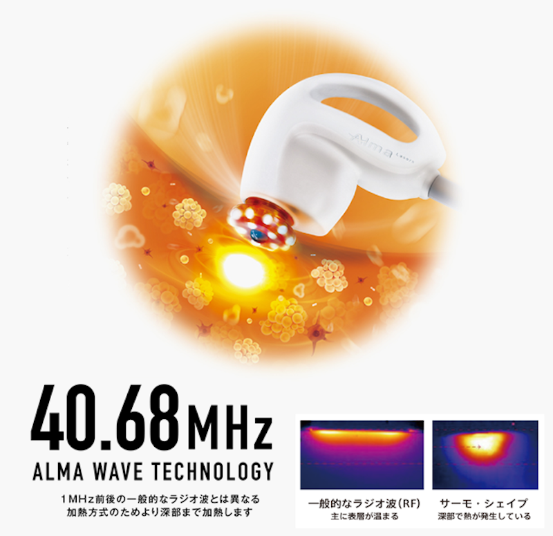 業務用痩身機・痩身マシンのおすすめ人気ランキング | マイベスト 業務用痩身機・痩身マシンのおすすめ人気ランキング | マイベスト