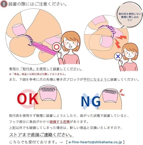 巻き爪ブロック 6