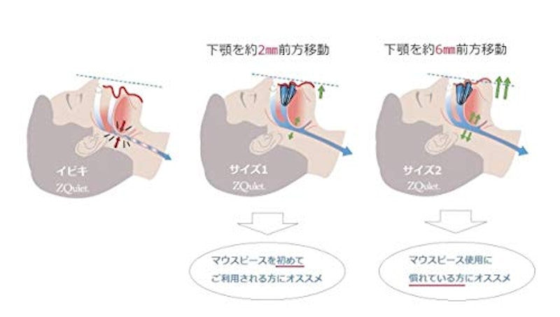 ズィークヮィェット 6