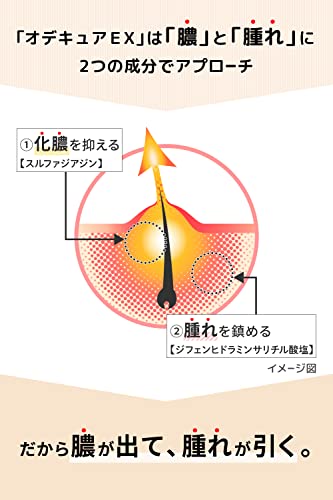 オデキュアEX　 5