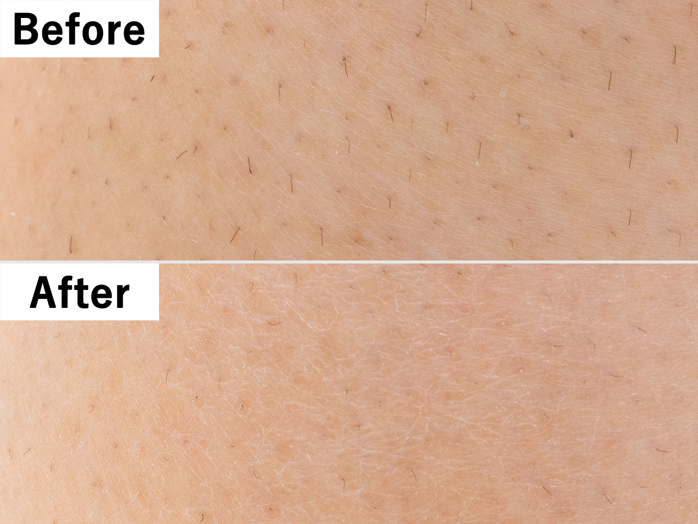 21年 除毛クリームのおすすめ人気ランキング14選 徹底比較 Mybest