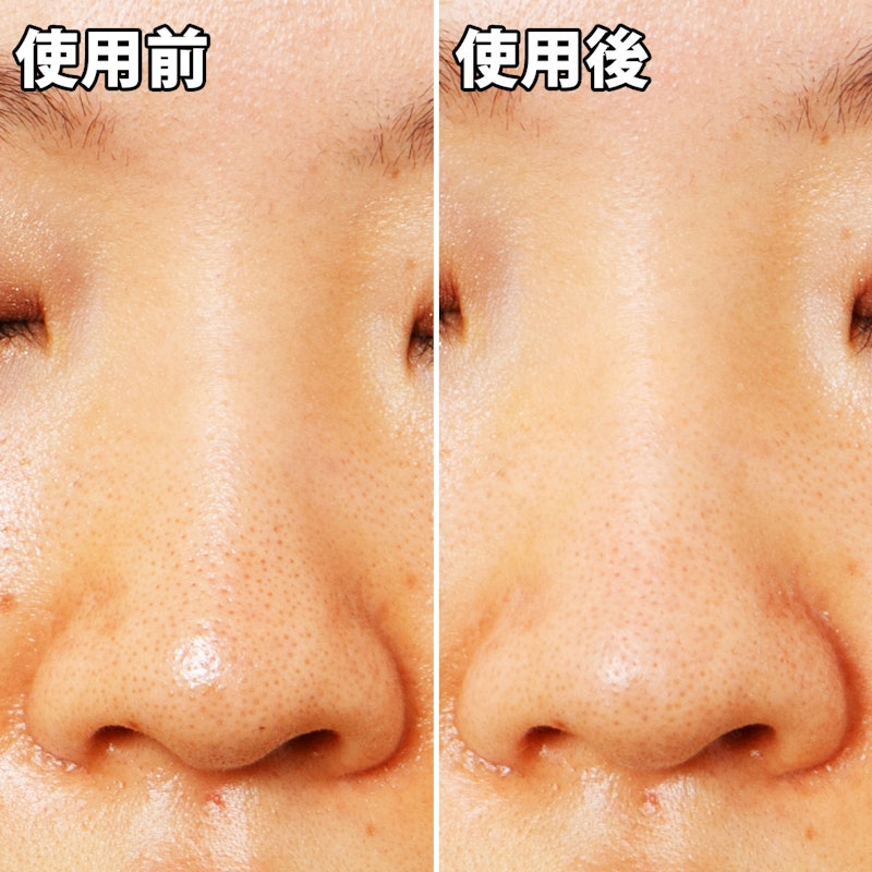 徹底比較 鼻の黒ずみ除去パックのおすすめ人気ランキング18選 Mybest