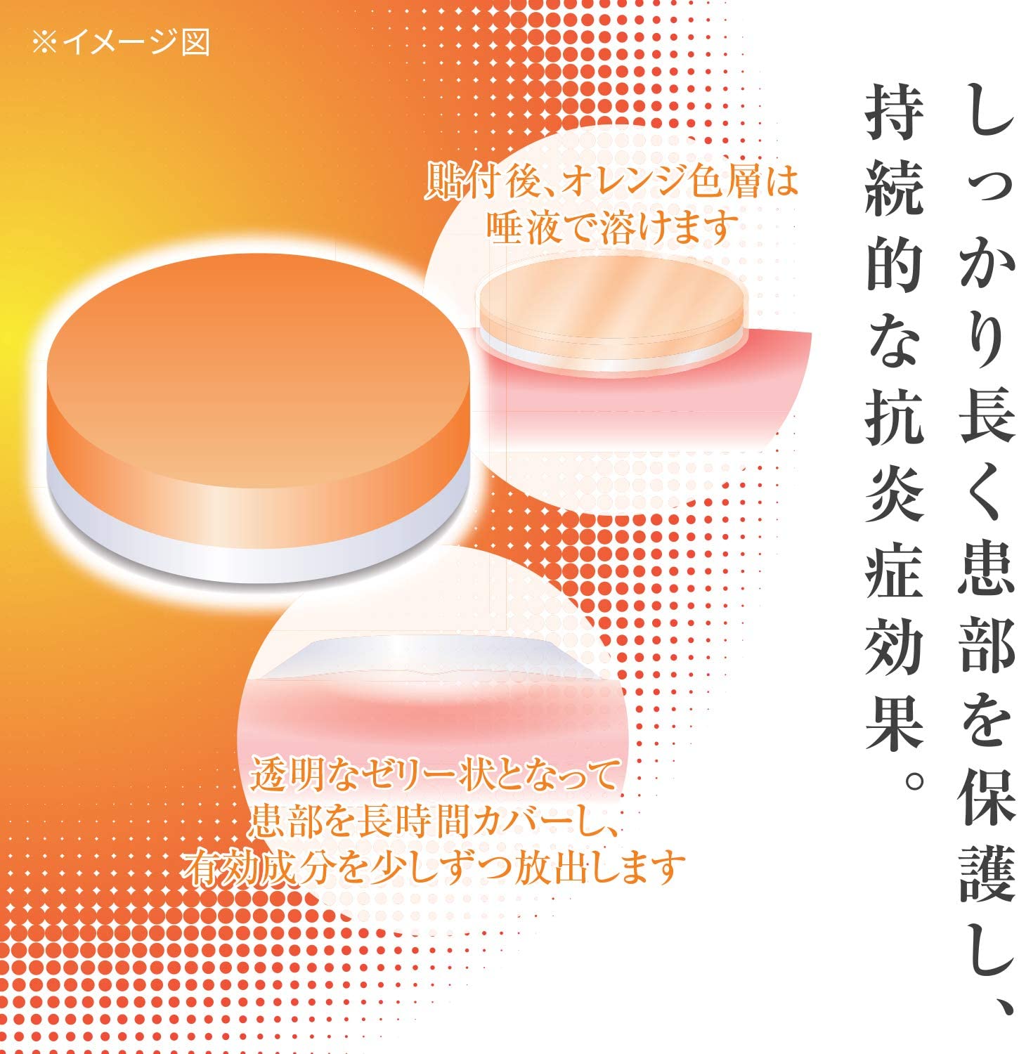 アフタッチA 3