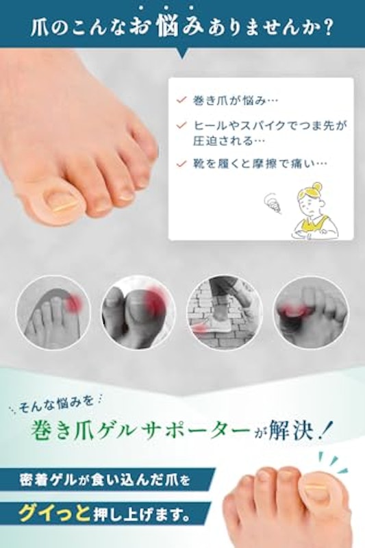 巻き爪ゲルサポーター 3