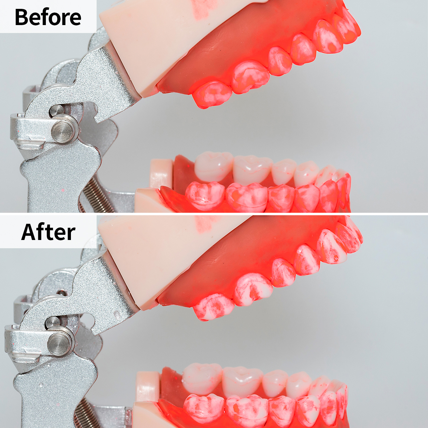口内クリーナー DENTAL WASHER 5