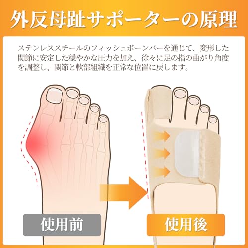 外反母趾サポーター 2