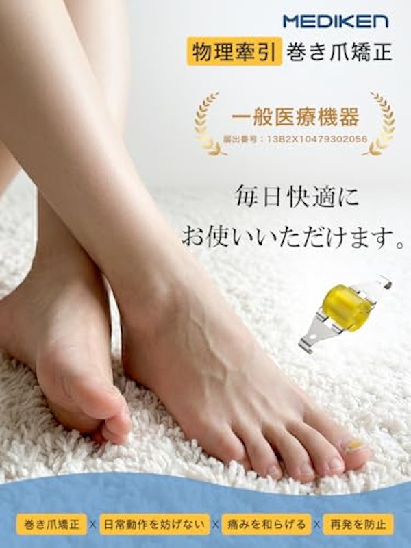 巻き爪矯正器具 2